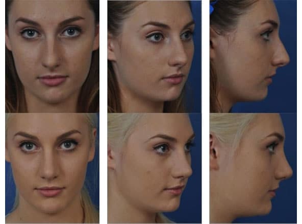 facial 8 - Facial Aging and Rejuvenation
