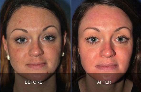 skin 2 - ZO Skin Health and Facials
