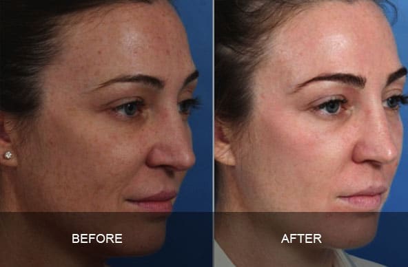 skin 3 - ZO Skin Health and Facials