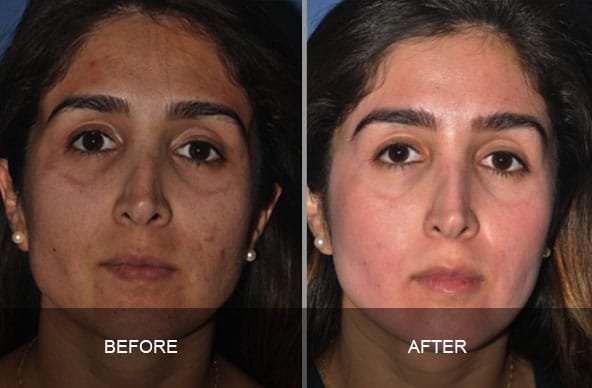 skin 5 - ZO Skin Health and Facials