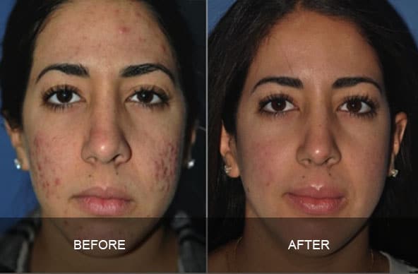 skin 6 - ZO Skin Health and Facials